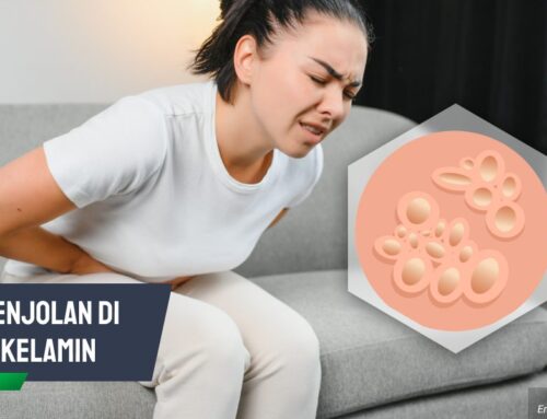 Benjolan di Kelamin Disertai Nyeri atau Gatal? Waspada Infeksi