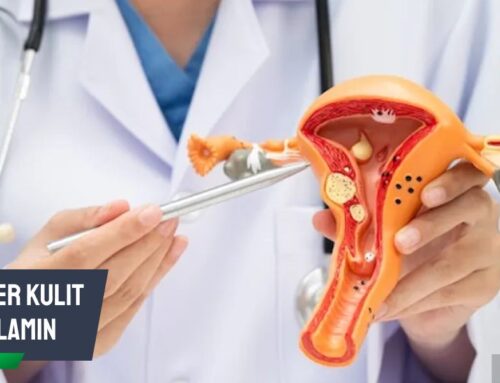 Mengapa Pilih Dokter Kulit Kelamin yang Tepat Sangat Penting?