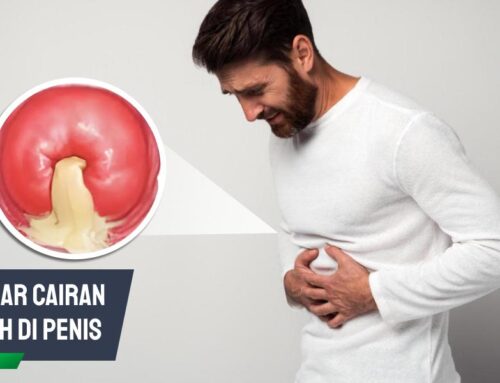 Penyebab Keluar Cairan Putih di Penis yang Perlu Diwaspadai