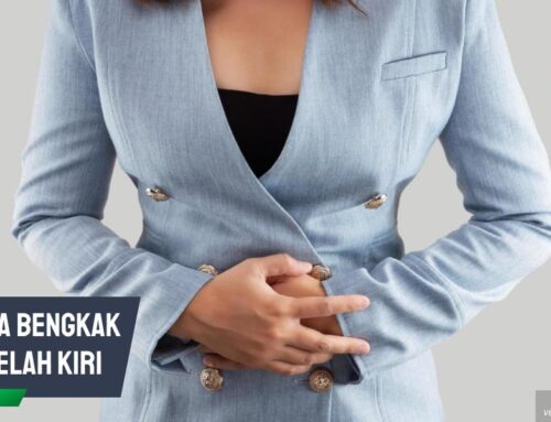 Vagina Bengkak Sebelah Kiri Tiba-Tiba? Ini Faktor Penyebabnya