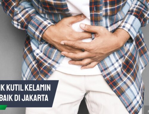 Cara Pilih Klinik Kutil Kelamin Terbaik di Jakarta untuk Hasil Maks