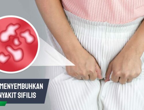 Cara Menyembuhkan Penyakit Sifilis dengan Tepat