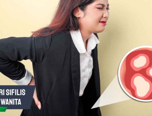 Ciri Ciri Sifilis pada Wanita: Gejala Awal dan Tandanya