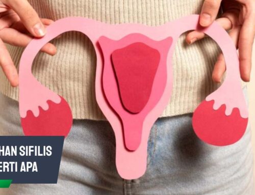 Keputihan Sifilis Seperti Apa? Kenali Ciri-cirinya