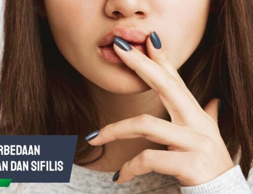 Perbedaan Sariawan dan Sifilis, Kenali Gejalanya