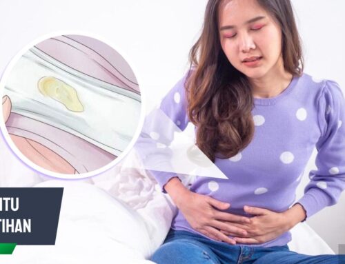 Apa Itu Keputihan? Kenali Jenis, Ciri, dan Penyebabnya