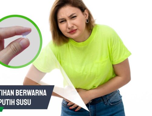 Keputihan Berwarna Putih Susu: Normal atau Berbahaya?