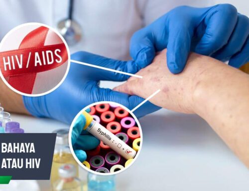Lebih Bahaya Sifilis atau HIV? Ini Penjelasannya