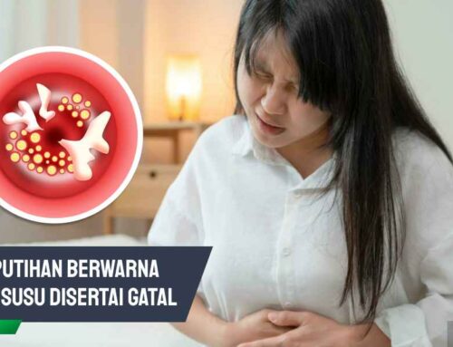Keputihan Putih Susu Disertai Gatal, Ini Sebabnya