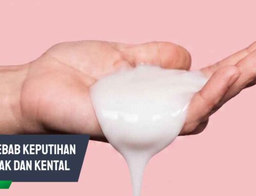 Kenali Penyebab Keputihan Banyak dan Kental Serta Solusinya