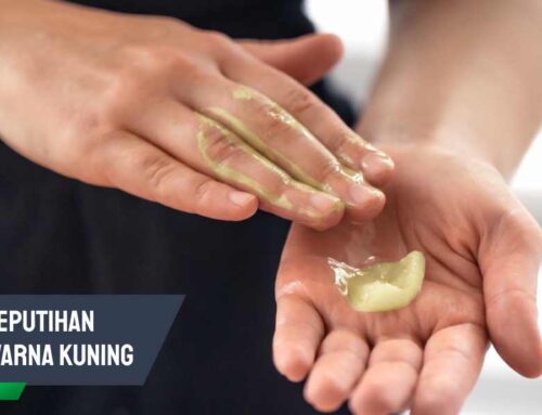 Waspada Keputihan Berwarna Kuning, Kenali Penyebab & Bahaya