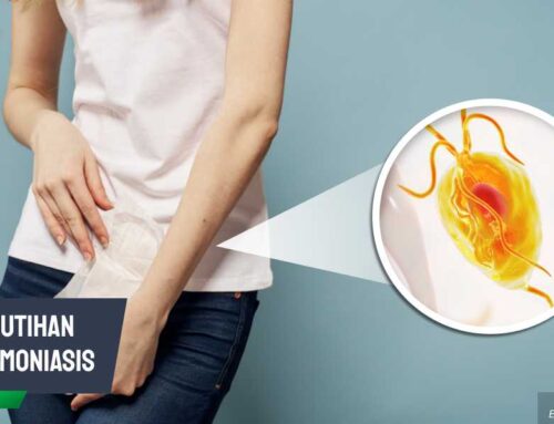 Kenali Ciri-ciri Keputihan Trikomoniasis dan Pengobatannya