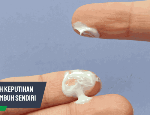 Apakah Keputihan Bisa Sembuh Sendiri? Ini Faktanya