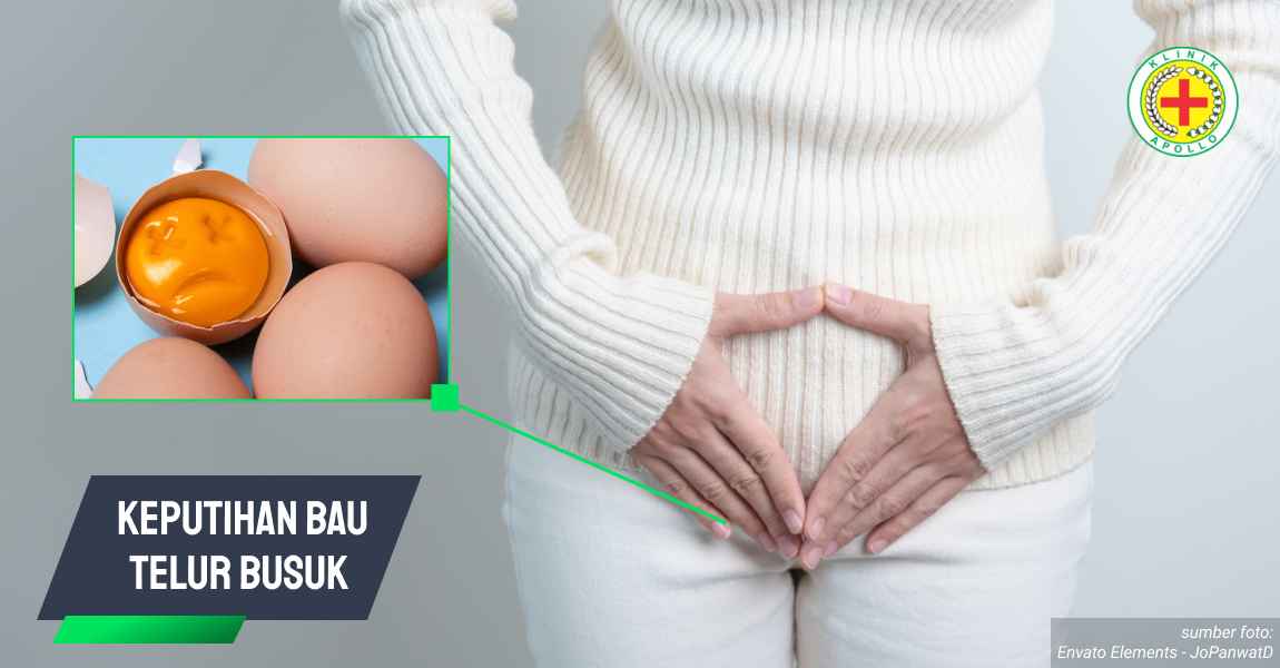 Ilustrasi Keputihan Bau Telur Busuk.